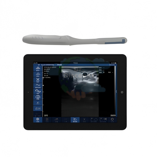 Система ультразвуковая диагностическая ЕЛС500Мини (беспроводная: бесплановая)